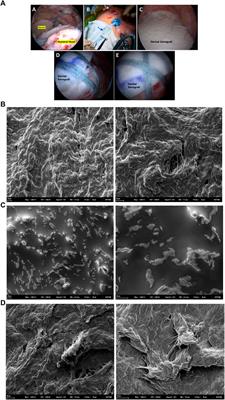 Evaluation of the Cell Behavior and Growth Characteristics of the Porcine Dermal Xenograft Patch in Relation to the Surface Properties